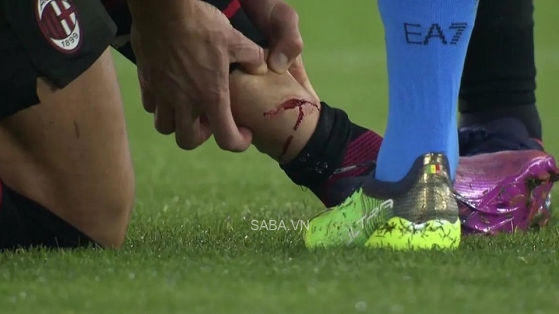 Giroud ghi bàn bằng chiếc chân bị thương