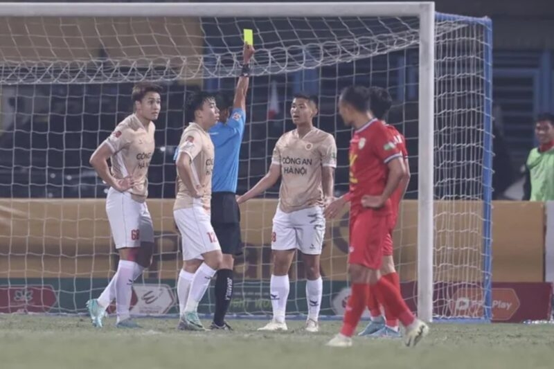 Tuấn Dương không thể ra sân tại vòng 13 V-League (Ảnh: Bongda24h)